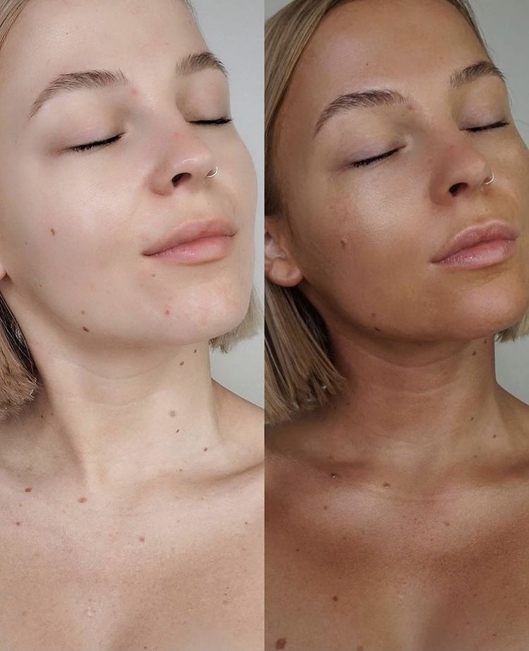 Gold Shimmer - Intensive Tanning Gel